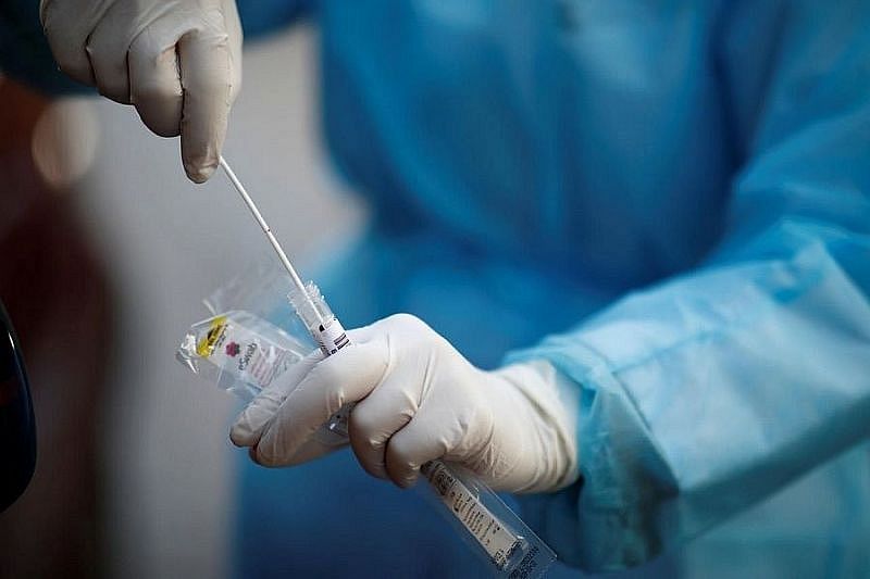 В России зарегистрирован первый в мире тест для выявления британского штамма коронавируса