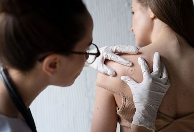 Маленькие и коварные: как уберечься от бородавок