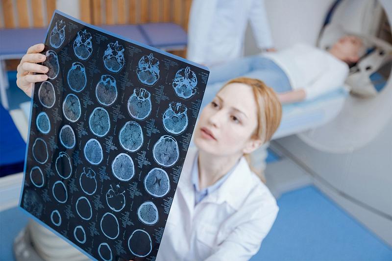 Названы главные симптомы рака мозга