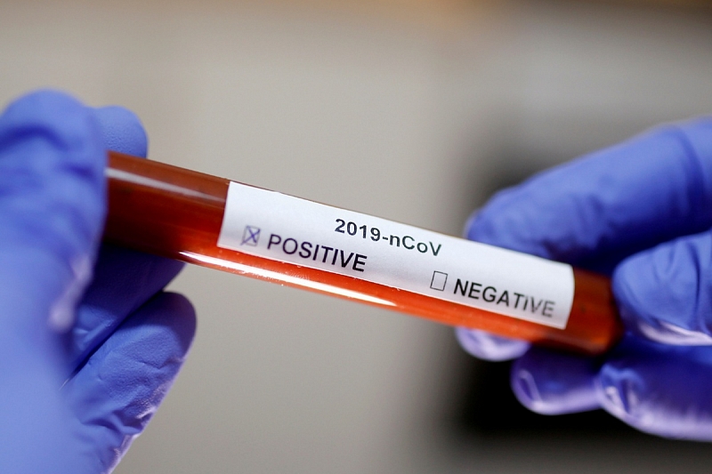 В Краснодарском крае подтверждено 11 новых случаев заболевания коронавирусом