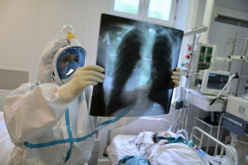 За последние сутки в Краснодарском крае подтверждено 82 новых случая заболевания COVID-19