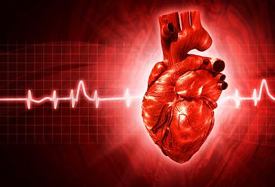  12 простых способов избежать инфаркта и инсульта