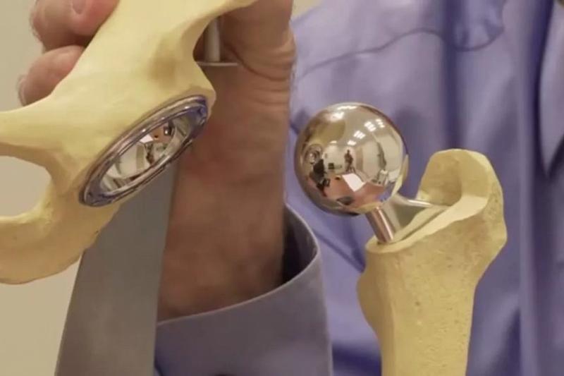 В России ученые разработали неизнашивающиеся протезы для суставов