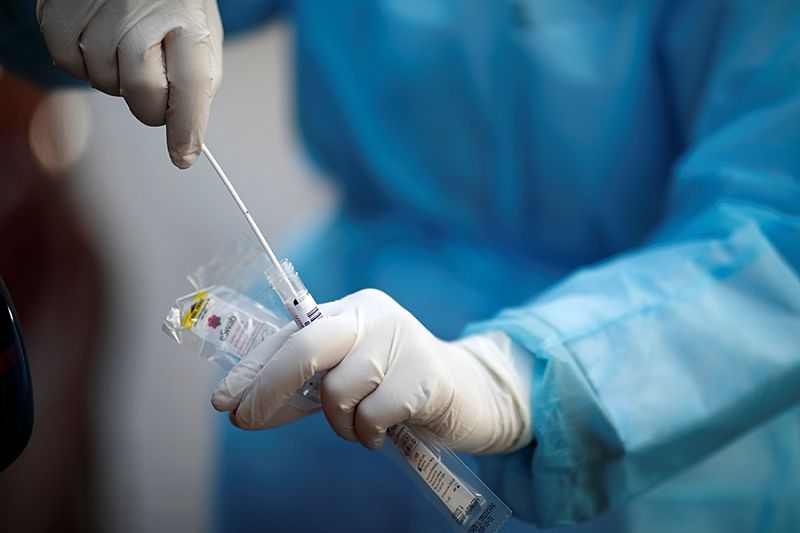 За сутки в Краснодарском крае выявили 33 случая коронавируса
