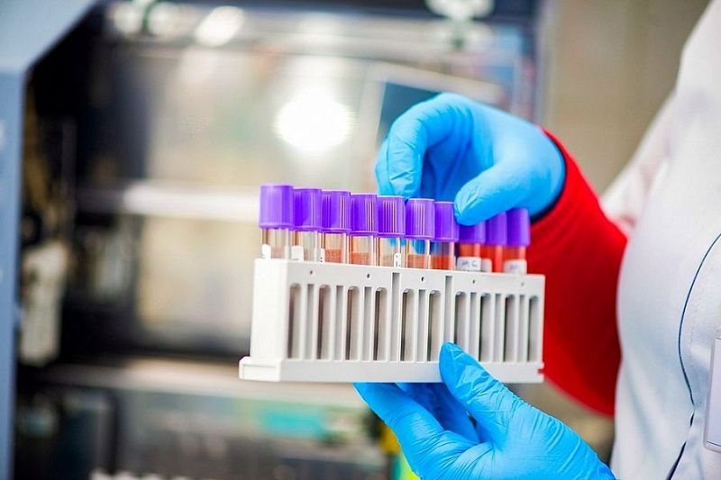 С начала пандемии лаборатории Краснодарского края провели более 2 млн тестирований на коронавирус