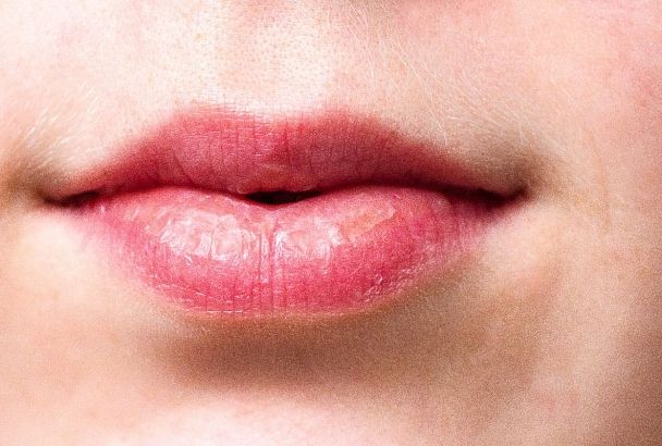 Симптомом каких заболеваний может оказаться сухость во рту