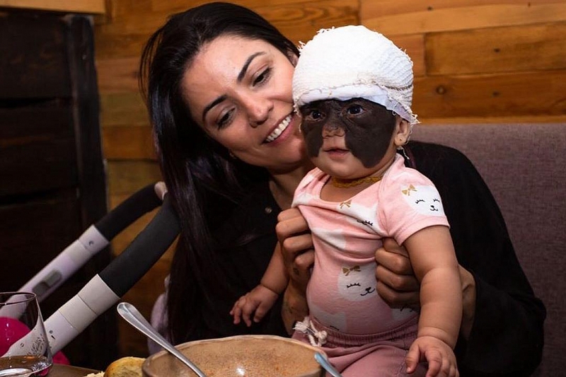 Мама девочки с «маской Бэтмена», прилетевшая на лечение в Краснодар, обратилась к россиянам