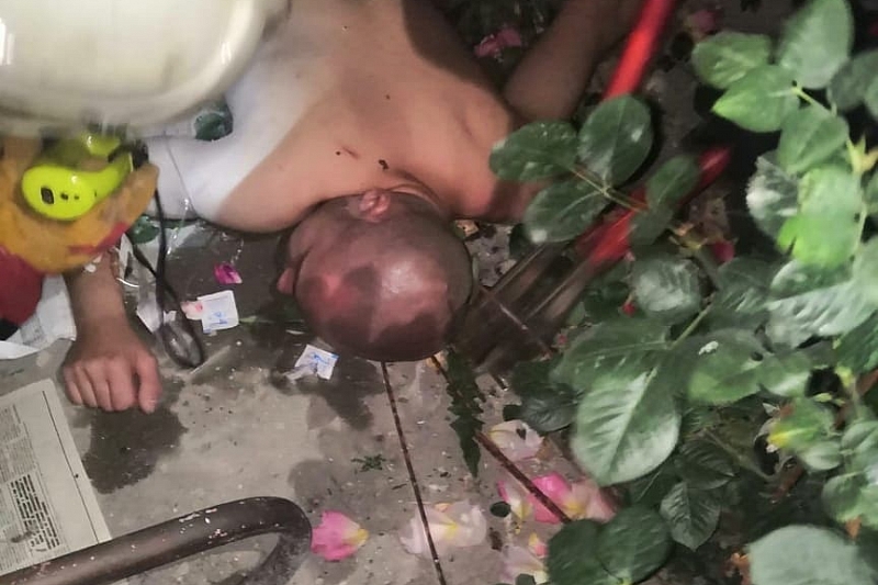 В Новороссийске мужчина упал на проволоку, которая проткнула ему шею