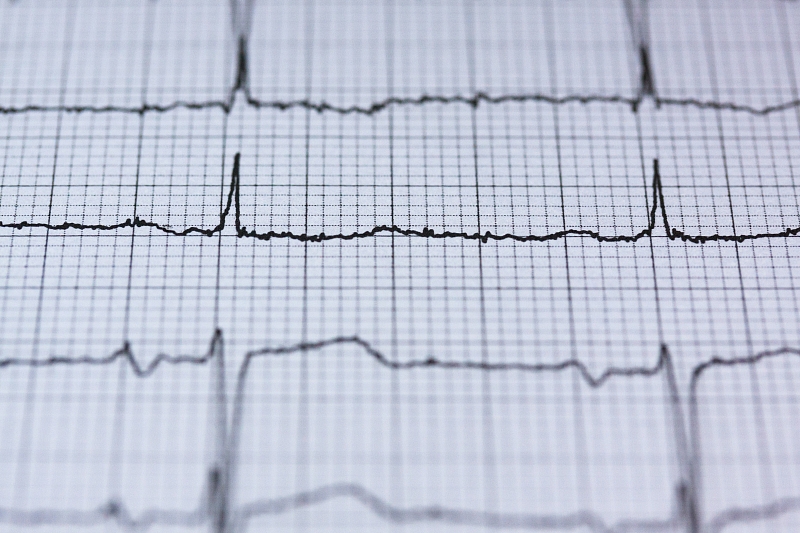 Медики назвали часто игнорируемые признаки инфаркта у женщин