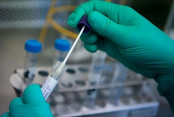 В России зарегистрировали уникальный тест на коронавирус