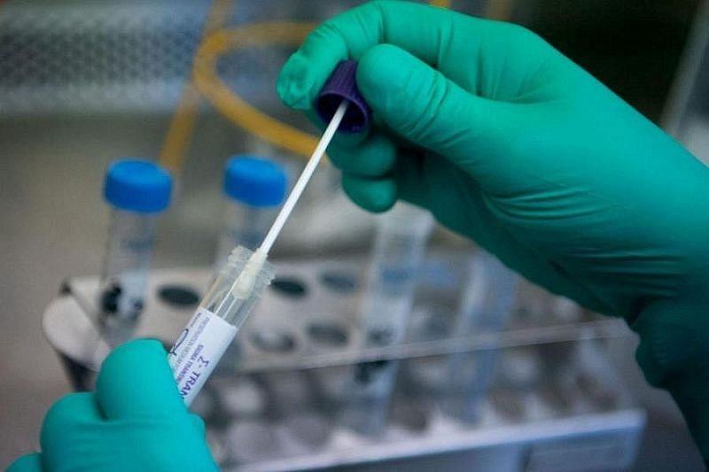 В России зарегистрировали уникальный тест на коронавирус