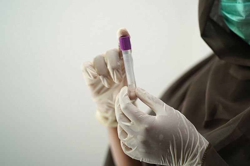 Роспотребнадзор рекомендовал работодателям тестировать сотрудников на коронавирус дважды в неделю