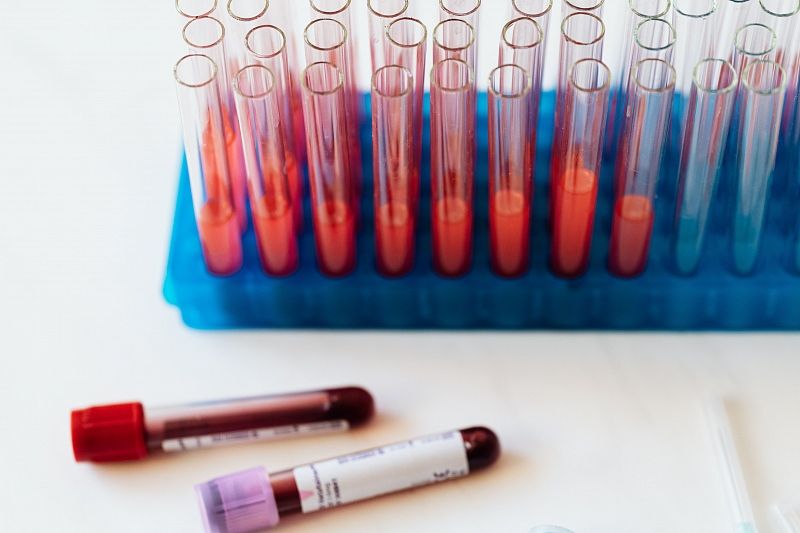 Антитела: все, что надо знать об анализе крови на иммуноглобулин