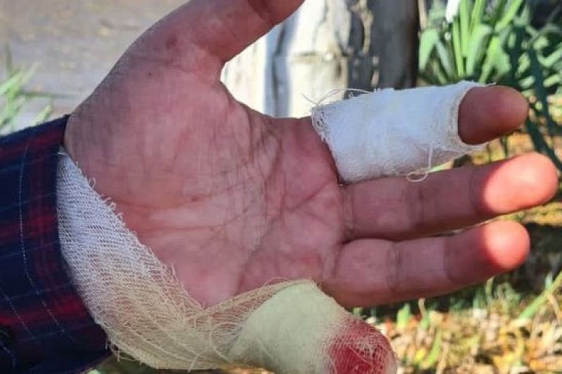 Помешал искать закладку: в Анапе двое мужчин отрезали охраннику палец
