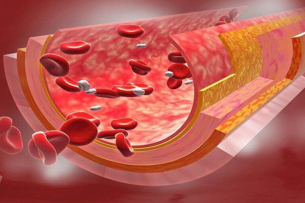 Как почистить сосуды в домашних условиях: вот для чего вашему организму нужен эндотелий, и как его восстановить