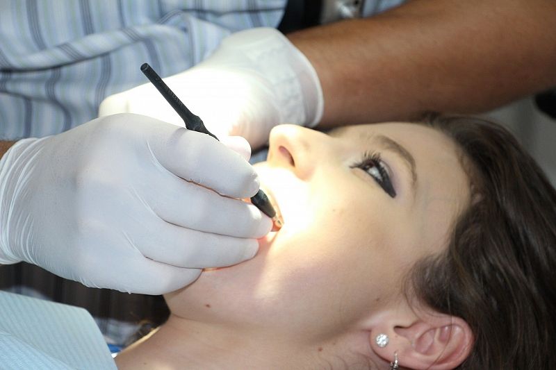 Стоматолог назвала простой способ сэкономить на лечении зубов