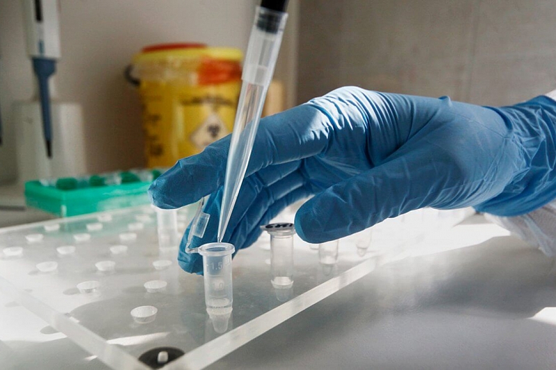 Российские ученые создали уникальный тест на «полезный» иммунитет к коронавирусу