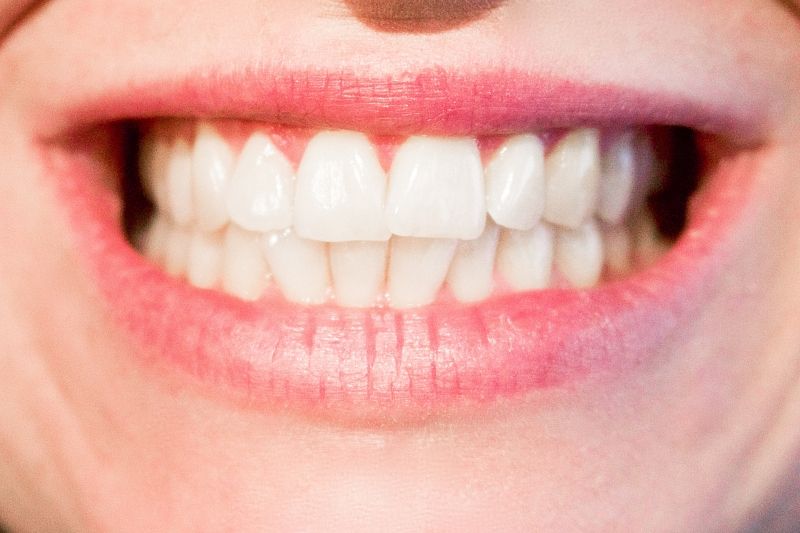 Не по зубам: что стоит исключить из повседневной жизни, чтобы реже посещать стоматолога