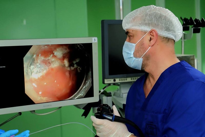 Врачи в Краснодаре провели редкую операцию по удалению крупного полипа из кишечника пациента 