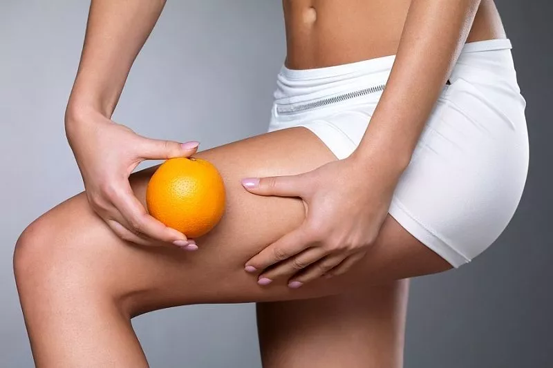 Два мифа о целлюлите: врач рассказала, можно ли на самом деле избавиться от «апельсиновой корки»