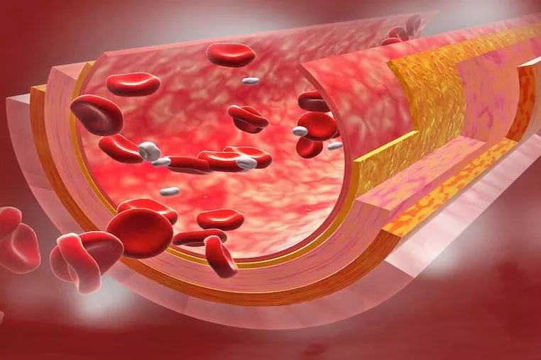 Как почистить сосуды в домашних условиях: вот для чего вашему организму ...